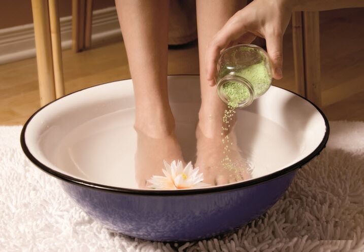Varice treatment