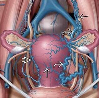 Change the structure of vascular walls