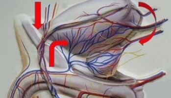 Varices of pelvic veins